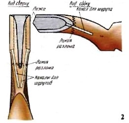 ������ ����� ����